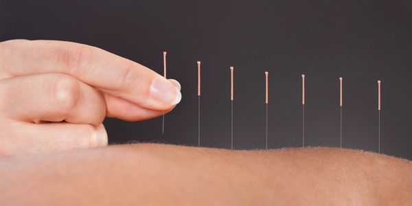 Acupuncture West